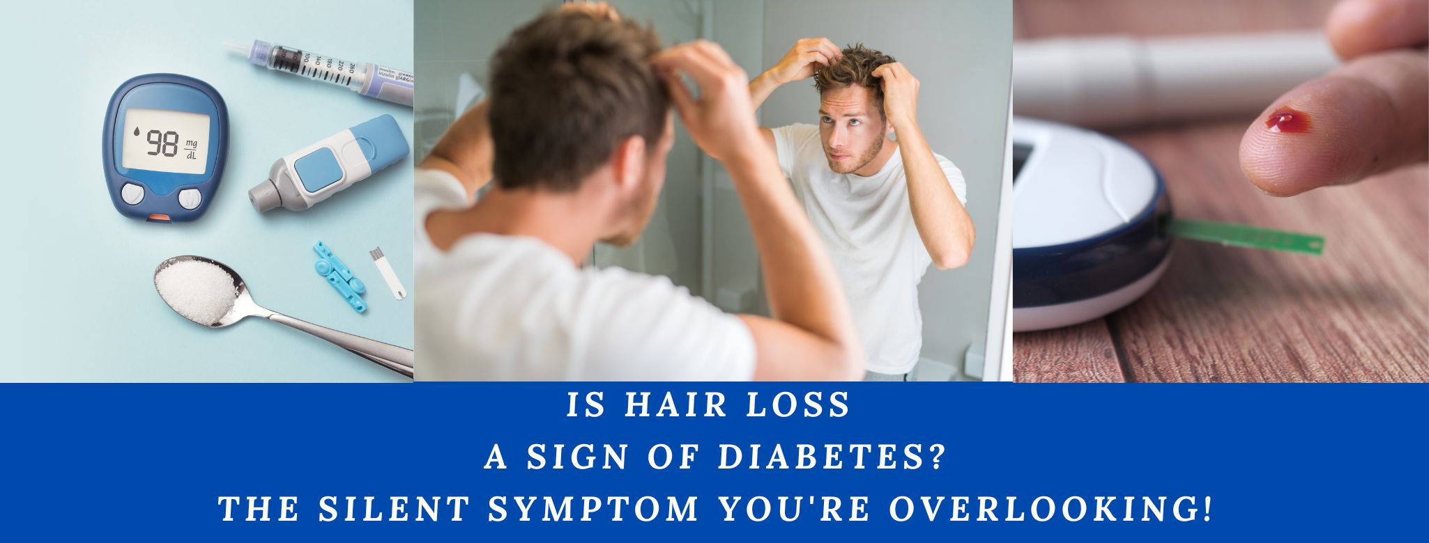 Is Hair Loss A Sign Of Diabetes